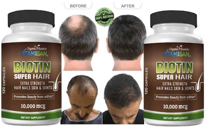 Hair Growth Supplements