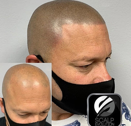 Why People Choose SMP