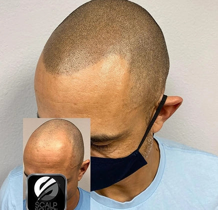 Why People Choose SMP