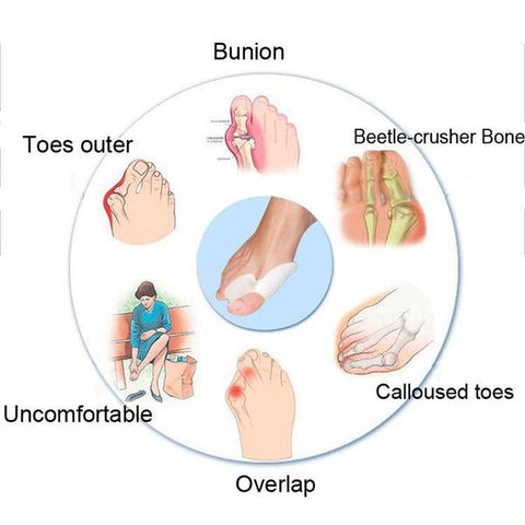 BunionFree™ Bunion Guard Toe Spacer