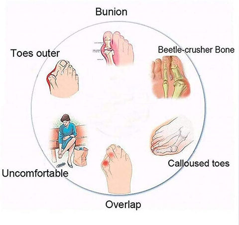 BunionFree™ Bunion Correction Sandals for Women