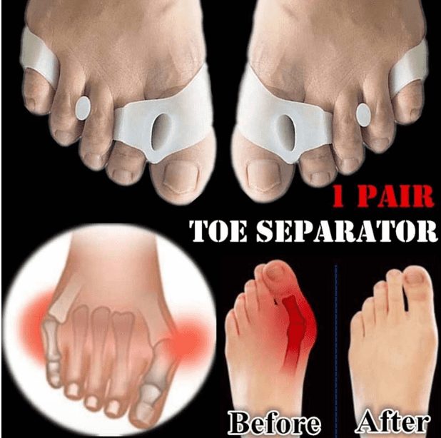 2 in1 Tailor's Bunion Toe Separator for Hallux Valgus