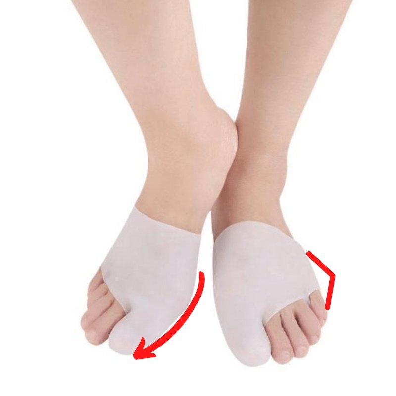 ComfyFootgear™ Silicone Sleeve Big Toe and Pinky Toe Corrector