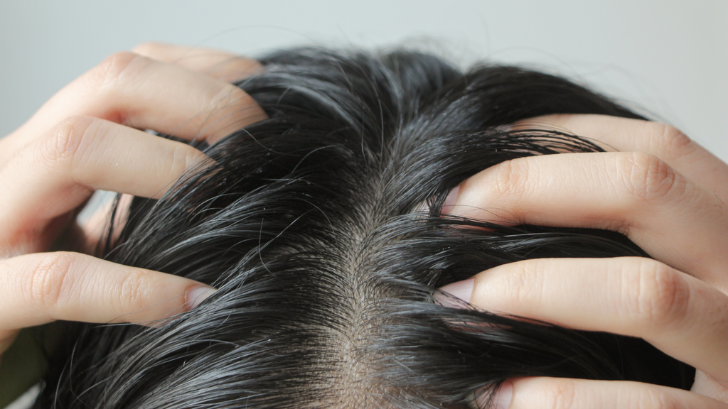 Top of head of a brunette woman touching her oily scalp with both hands