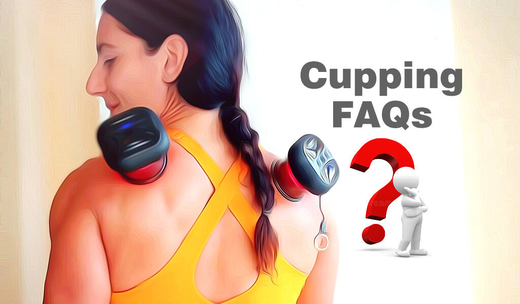 cupping faqs