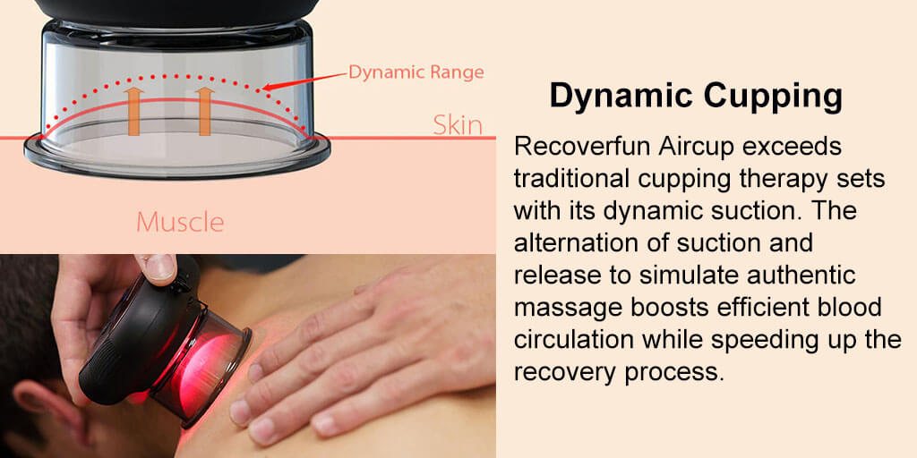 how cupping massager work?