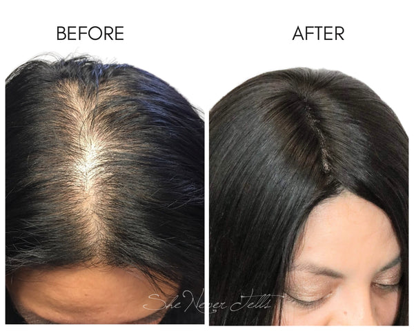 Left: Before photo of woman with female pattern hair loss. Right: After photo of woman wearing a custom topper to conceal her hairloss.
