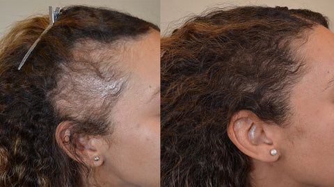 Scalp & Hair Restoration Paste, 8 oz - Ayur's Batch of Nature, LLC
