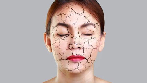 Konea-London Comment ne plus avoir la peau sèche du visage