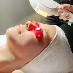 IPL Facial