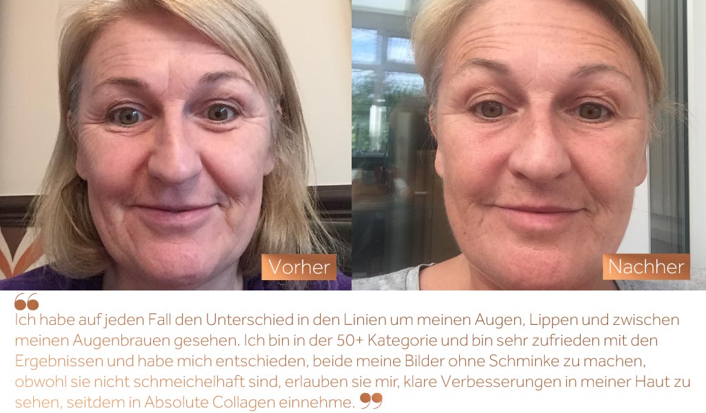 Before and after photos showing the improved skin smoothness of a white woman's face after taking Absolute Collagen