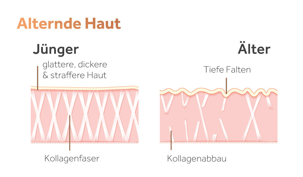 Bild zeigt die Kollagenstruktur jüngerer Haut und den Kollagenabbau älterer Haut