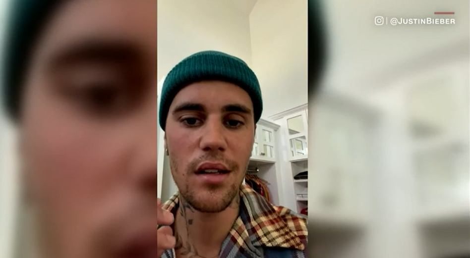 Mettalusso rapporte sur le virus Justin Bieber
