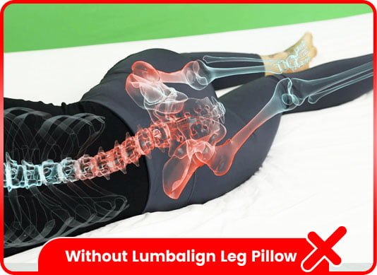 without lumbalign leg pillow