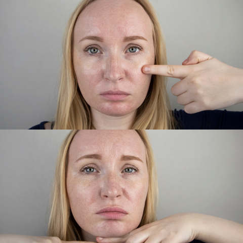 Woman with Oily Skin Pointing at Her Face