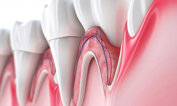 Was hilft gegen Zahnfleischbluten – Zahnfleischbluten rechtzeitig behandeln