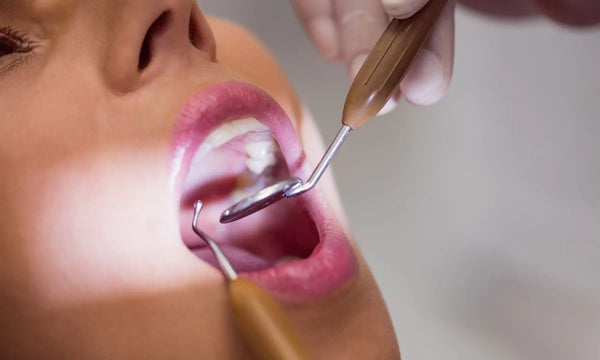 Zahnstein entfernen - Professionelle Zahnreinigung
