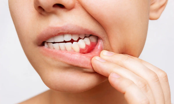 Zahnfleischrückgang Ursachen, Symptome, Folgen