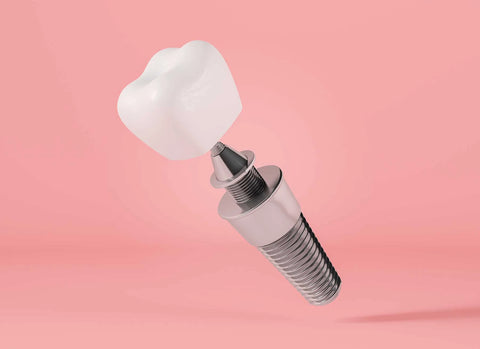 Denture care - dental implant: MINT Biotic
