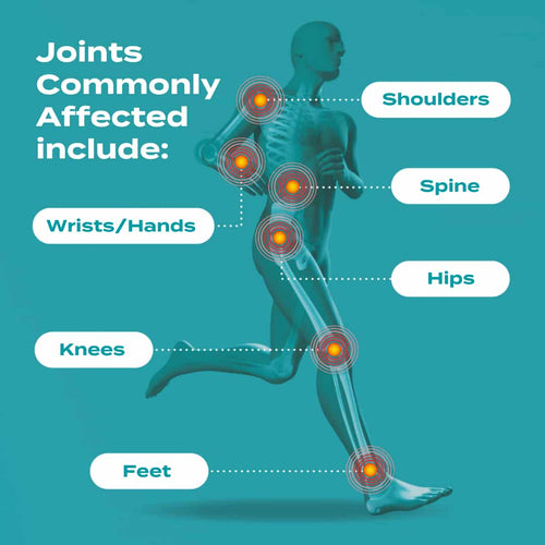 joints commonly affected