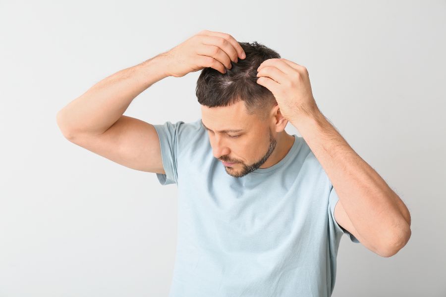 How To Repair Damaged Hair In Men – Traya