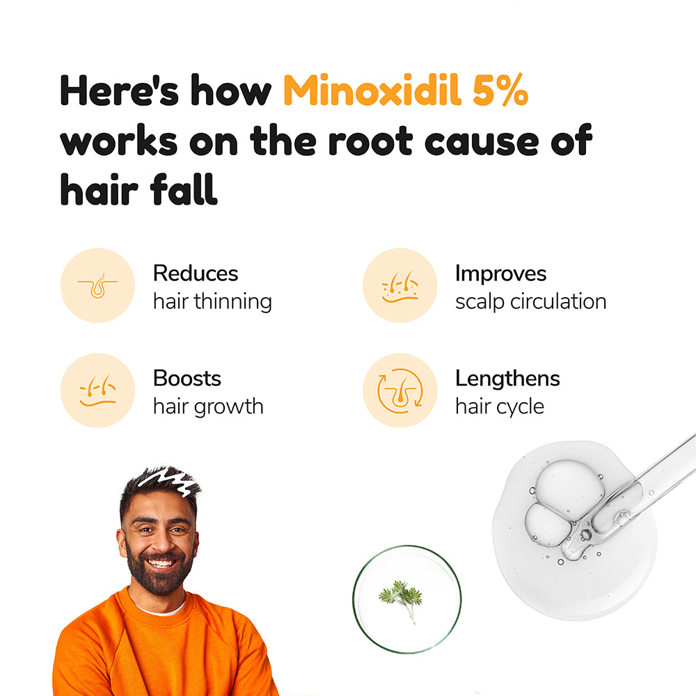 What You Need To Know About Trying Minoxidil Treatments  Haircom By  LOréal