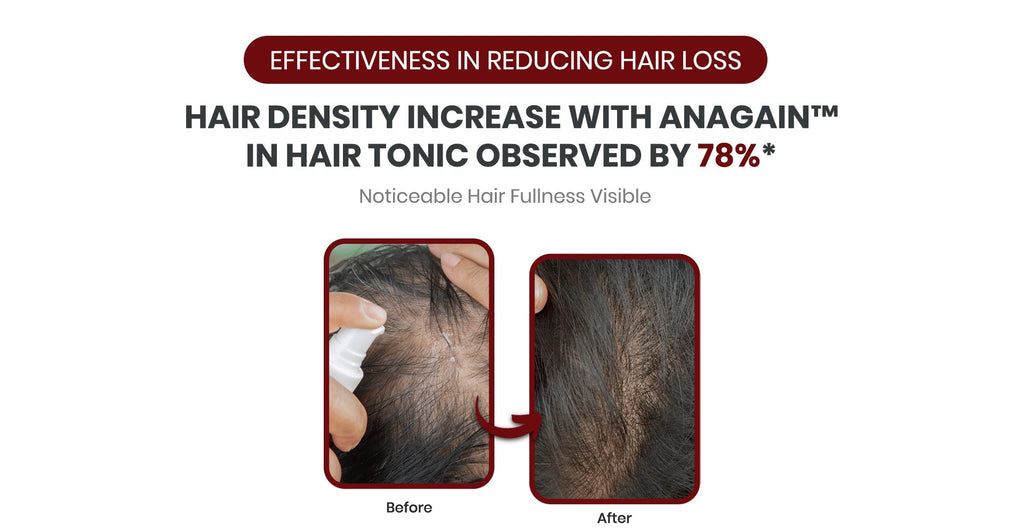 NANOSKIN SG Hair Tonic 150ml | Best Hair Tonic