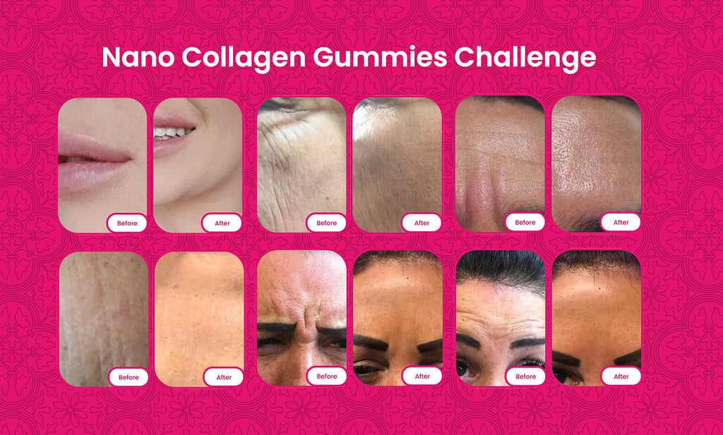 Nano Collagen Gummies Challenge best collagen gummies