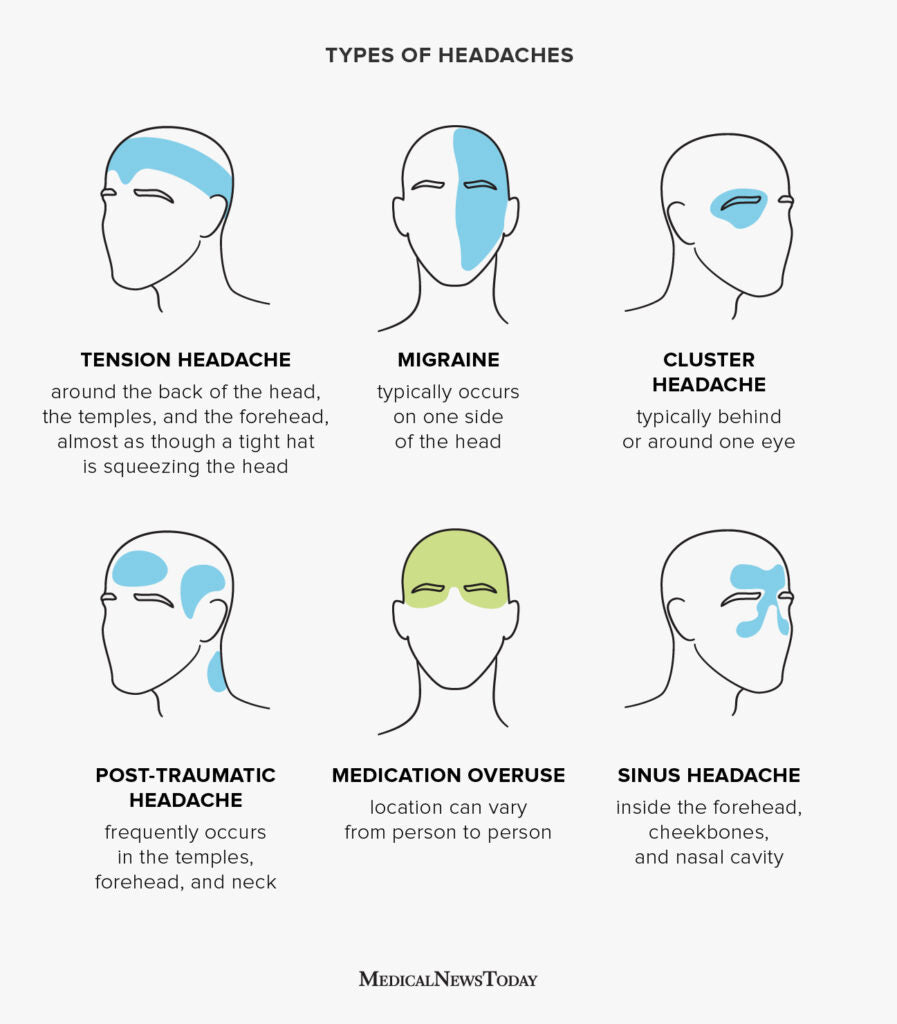 Tracing The Many Causes Of Headache – Nano Singapore Shop