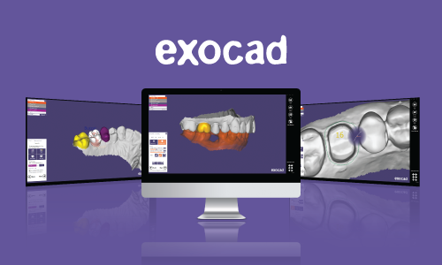 exocad