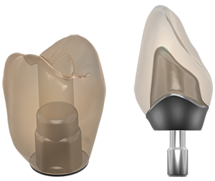 implant crown