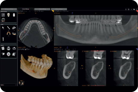 Evaluate bone quantity and quality, and localise anatomical obstacles