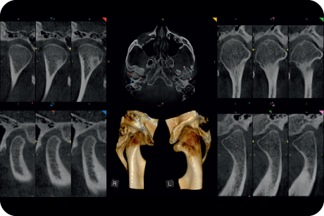 Access TMI and occlusion