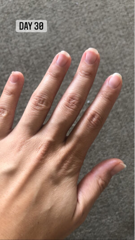 day 30 after taking inner hair nutrition bites nail growth results