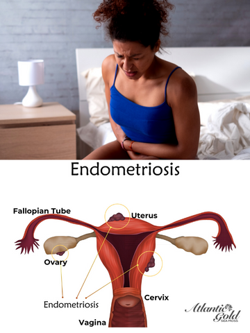 endometriosis, sea moss benefits, seaweed, fibroids, pelvic pain, painful periods