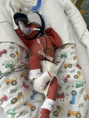 Premature Baby with CPAP mask laying on back in isolette in NICU