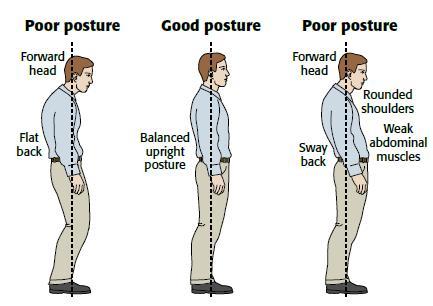 BackSuccess Posture Corrector