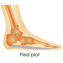 Pied Plat - Image Illustrant La Plante Du Pied