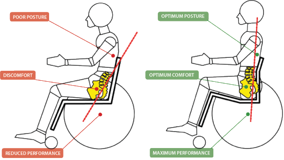 Wheelchair clinical seating and positioning