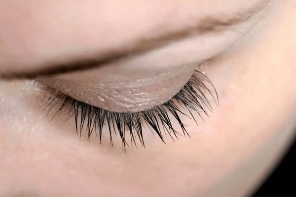 eyelash health