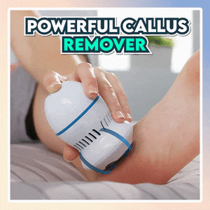 foot callus remover
