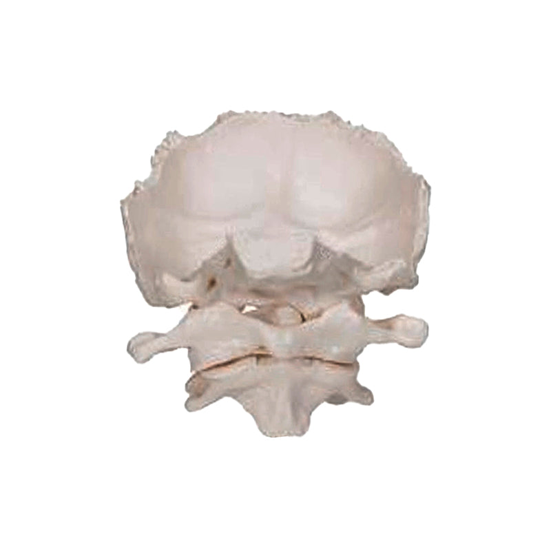 Atlas and Axis with Occipital Plate Model [SKU: MG20268]