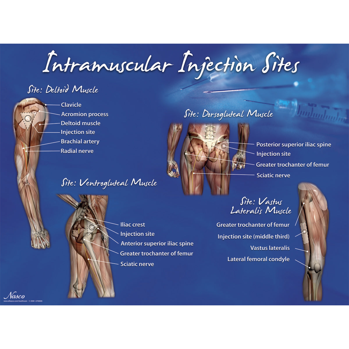 Intramuscular Injection Sites Poster Nasco Healthcare   LF00695 Main 2100x 