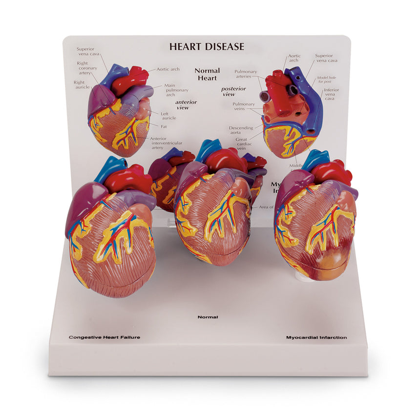 Heart Model (2-Piece) [SKU: SB32595] – Nasco Healthcare