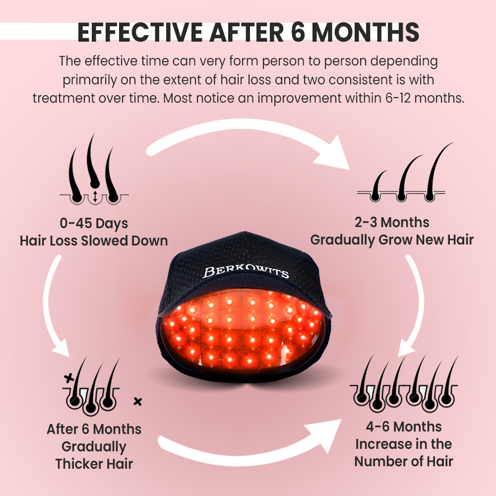 7 Things You Should Know BEFORE You Buy a Laser Helmet Cap or Comb