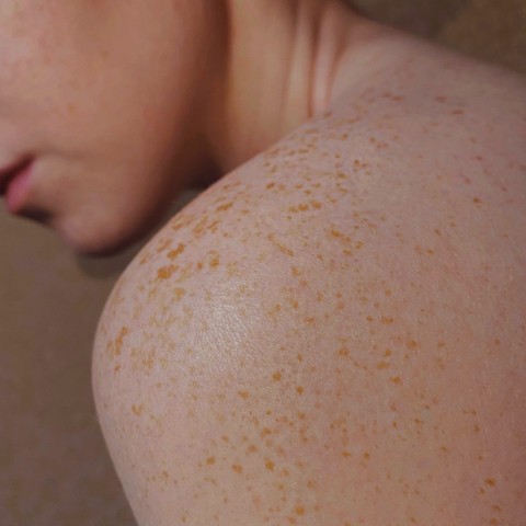 How to take care of sensitive skin skincare for sensitive skin