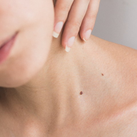 How to take care of sensitive skin, skincare for sensitive skin