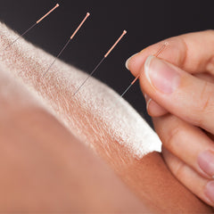 acheter des aiguilles d'acupuncture chez lierre canada