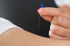 buy acupuncture needles without a license
