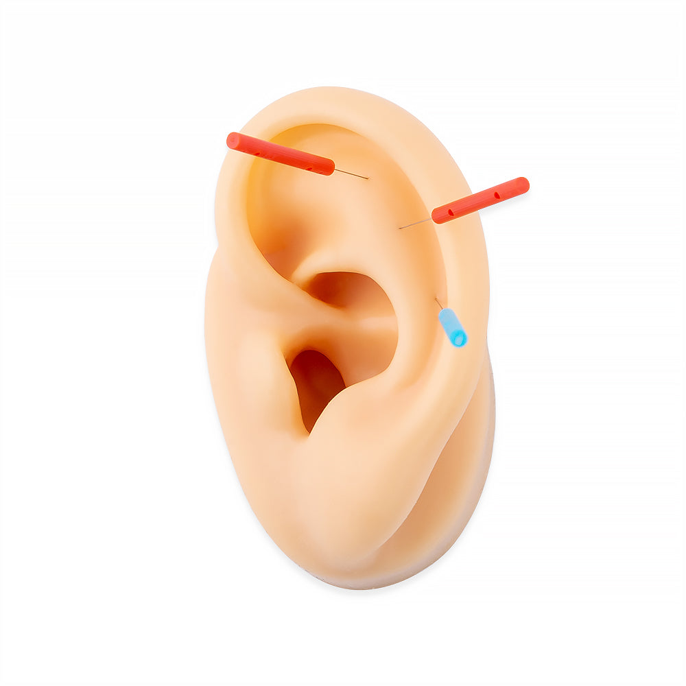 Sterile Acupuncture Ear Press Tacks - Aculine